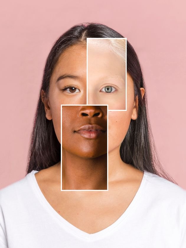 Skin type